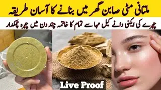 Homemade Multani Mitti Soap Remedy | Remove Pigmentation | Acne Treatment at Home