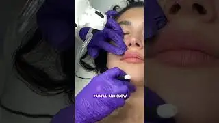Say Bye to Unwanted Facial Hair Forever | Furless Permanent Electrolysis Treatment  #electrolysis