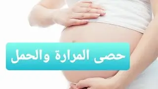 حصى المرارة و الحامل مع الدكتورة إبتسام الكعبي