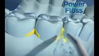 Portable Power Floss Dental Water Jet Tooth