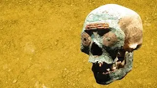 The Archaeology of Disease Documented in Skeletons - Professor Charlotte Roberts