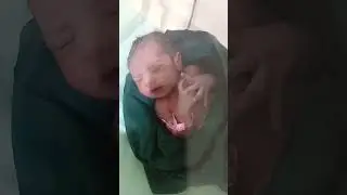 Newborn baby how looks cute when she seen first time after birth