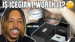 Trying My NEW ICEGIANT GRILLZ! Full Review + Try-On 🔥