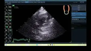 IQ 369 AFI LA  ECHOCARDIOGRAPHY REACTIVE LYMPHOTITIS HWD ULTREASOUND SMALL ANIMAL CAT