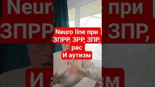 neuro line CBD как работает при - #зпр #зпрр #зрр #рас #neuroline #cbdмасло