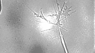 DIC imaging of a zebrafish spinal neuron growth cone in culture - dynamic remodeling at the axon tip