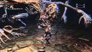 Bloodborne&trade; Defiled Amygdala (No Damage Run)