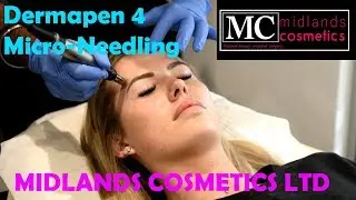 Dermapen 4 Treatment with Midlands Cosmetics