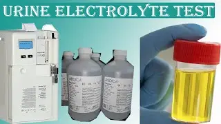 Urine Electrolyte Test Procedure & Normal Value full details.