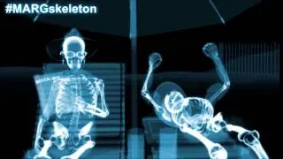 MARG The Skeleton
