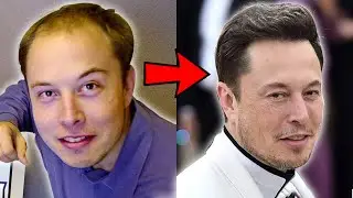 How Elon Musk Reversed His Hair Loss
