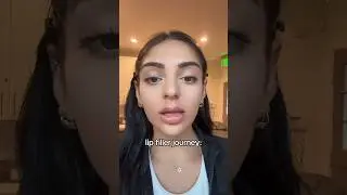 LIP FILLER - before & after