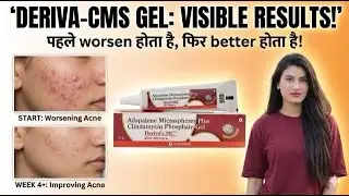 Deriva Cms Gel how To Use | Adapalene Microspheres Plus Clindamycin Phosphate Gel  | Side Effect