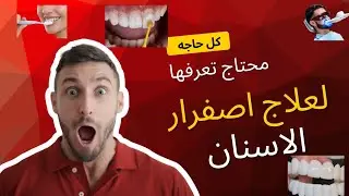 أسباب اصفرار الأسنان وعلاجها بالتفصيل | التبييض والعناية وتنظيف الجير والفينيرز