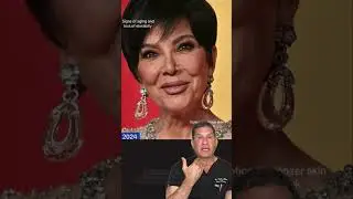 Kris Jenner Got A Facelift?! Let's break it down!
