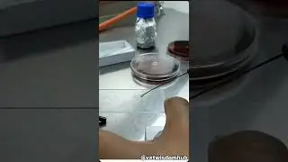 📌 KOH Test: The Simple & Effective Fungal Diagnosis Method! 🦠🔬#KOHtest #MicrobiologyLab