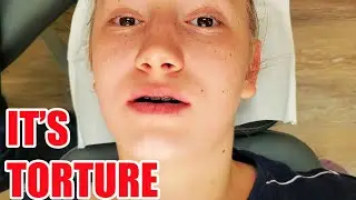 Virginia Gets THE TORTURE DEVICE | Mara Orthodontic Device #seekyourtruth