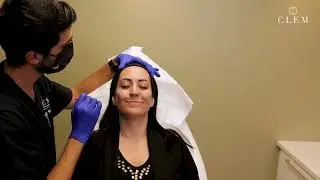 CLEM -  Botox