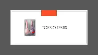 Torsio Testis