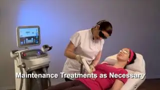 Лазерный аппарат - elos Plus (Элос Плюс) от Syneron