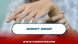 Wrist Drop | Dr. Ezekiel Oburu