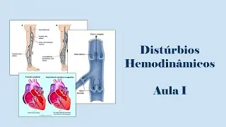 Distúrbios Hemodinâmicos - Aula I