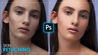 High-End Skin Retouching in Photoshop