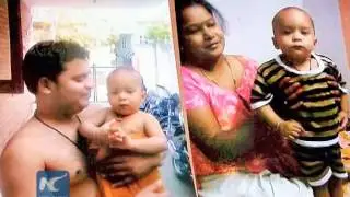 Dengue fever outbreak in India