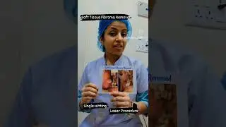 Soft Tissue Fibroma Removal #painless #bloodless #stitchesfree #lasersurgery #cuspdental #dwarka