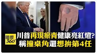 川普手背驚見