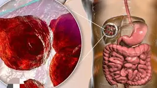 #Git system,#topic 13#liver cyst #introduction , causes,#treatments #y #medical #explanation #हिन्दी