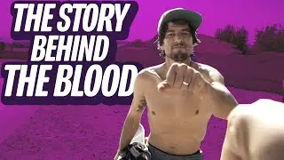 A Closer Look: EMAN's Bloodiest Battle! Screaming Vlog 81 | Santa Cruz Skateboards