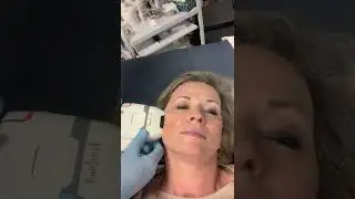 Video Hifu behandeling