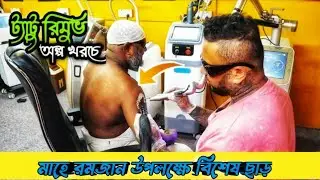 How Laser Tattoo Removal Works Bangladesh । BD Tattoo Remove Center Dhaka । How To Work |Arfan Vlogs