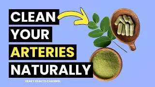 8 Best Vitamins That May Help Slow Plaque Buildup in Your Arteries