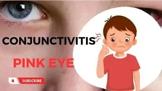 Conjunctivitis (Pink eye, Eye flu) 🥺 | Awareness Series