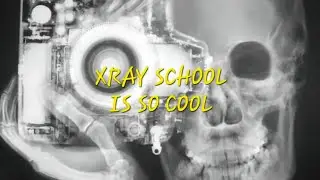X RAY SCHOOL IS SO COOL -a song