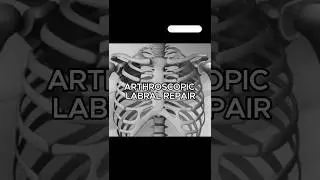 Push Lock Shoulder Repair Explained | Dr. Pavan Chebbi | Cartilage Tear & Labrum Repair