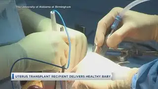 Uterus Transplant Recipient Delivers Healthy Baby