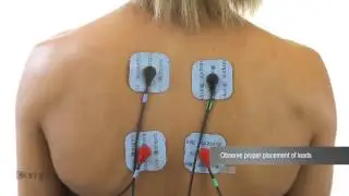 Upper Back Electrode Placement for Compex Muscle Stimulators