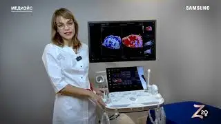 HERA Z20 обзор 2