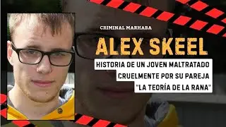 HISTORIA DE UN JOVEN MALTRATADO CRUELMENTE POR SU NOVIA: ALEX SKEEL