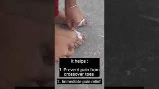 CuraFoot Bunion Protector for Bunion Pain : Visit our website www.curafoot.in