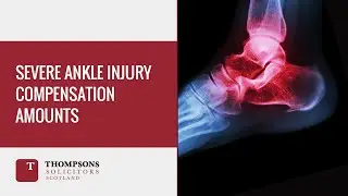 Severe Ankle Injury Compensation Amounts