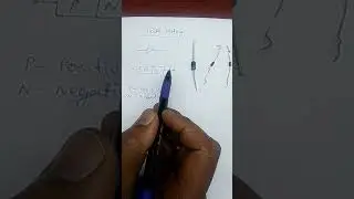 Testing of diode