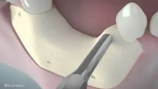 La Mesa Dentist
