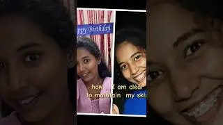 Pimple clear #whining #minivlog #myma #brighting #face#faceclearskin#whiting#fashion #nikhitha