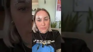 After 11 Years, She Finally Said Goodbye to Her Old Brows 💫  Laser Tattoo Removal Results #eyebrows