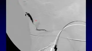 Imaging of the Eye and Orbit, Part 6
