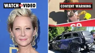Anne Heche, Ellen DeGeneres&rsquo; ex-girlfriend, severely burned after LA crash